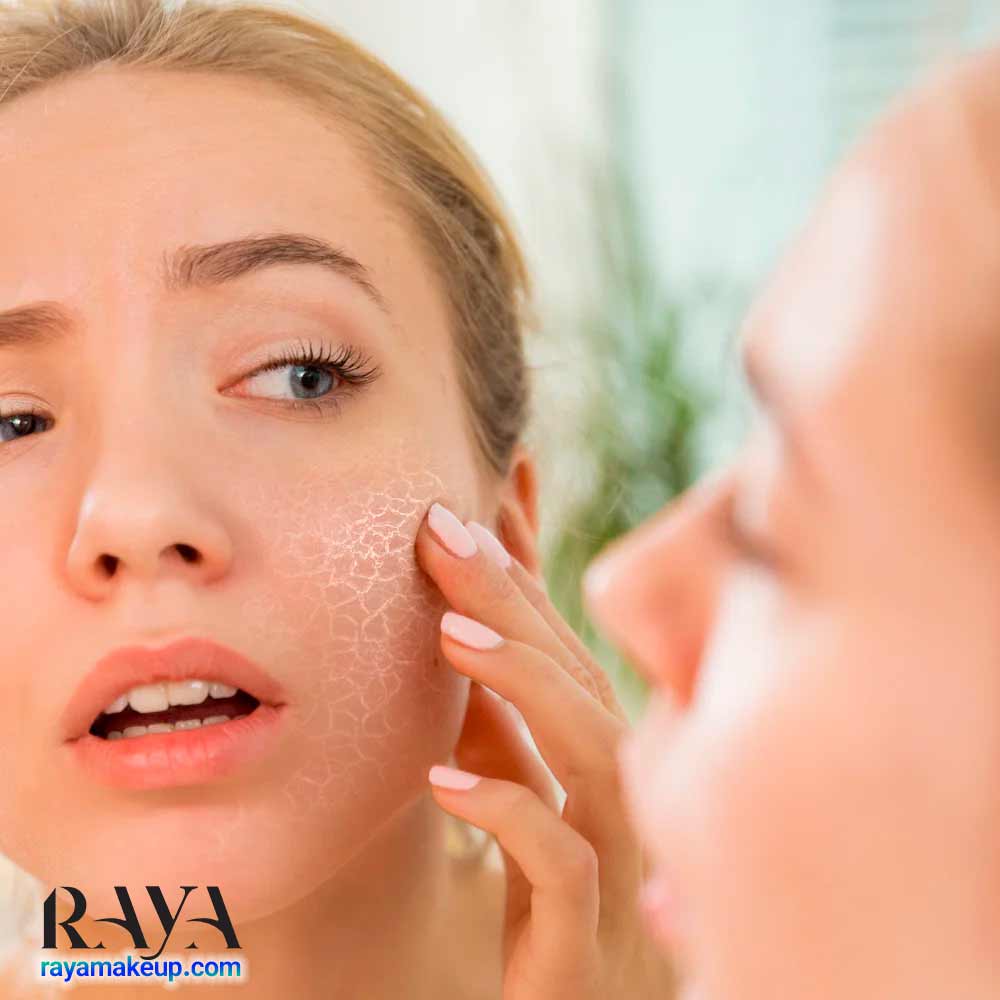 چگونه متوجه شویم که پوستمان کم آب و دهیدراته شده است؟