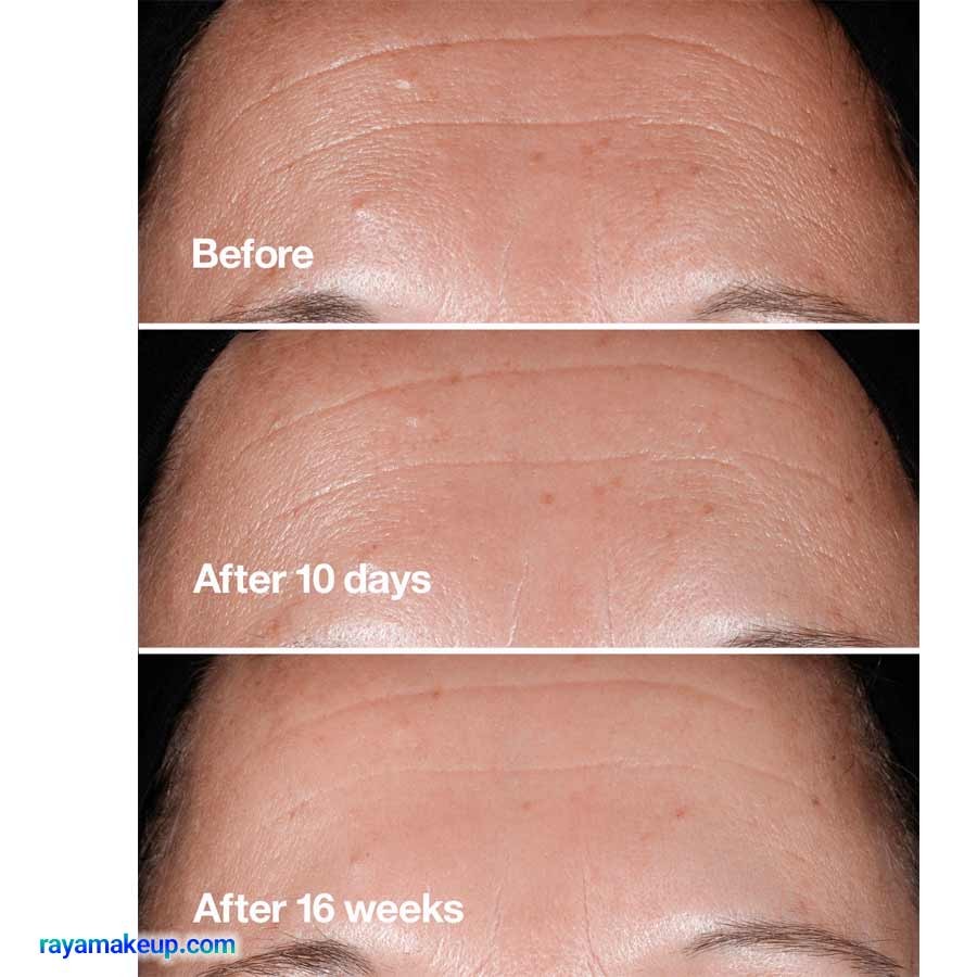 سرم ضد چروک کلینیک مدل اسمارت کلینیکال ریپیر Clinique Smart Clinical Repair Wrinkle Correcting Serum