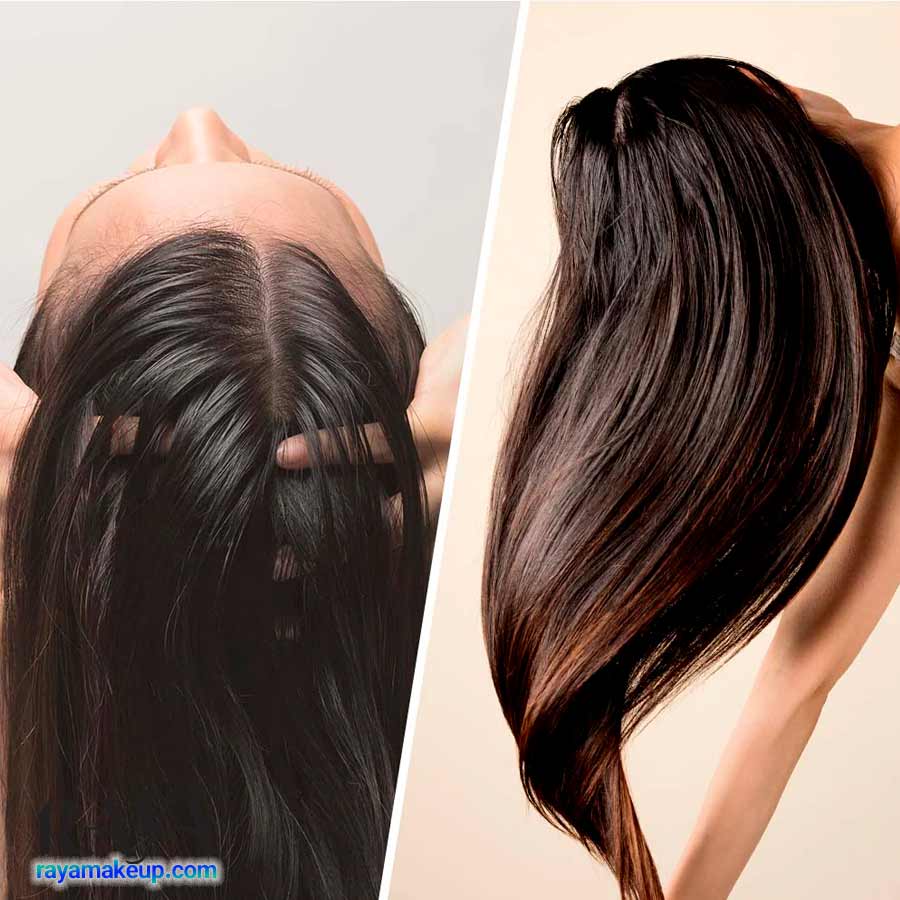 در مورد اسکراب و لایه برداری پوست کف سر چه می دانید؟