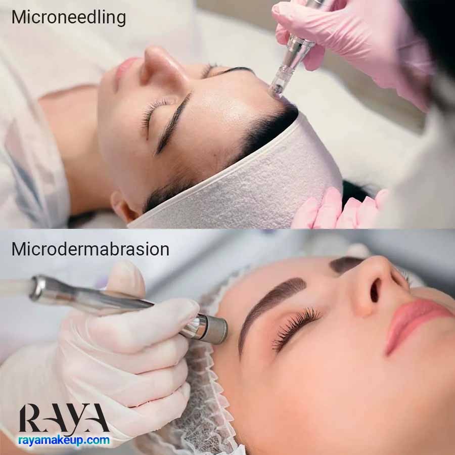 نکات مهم و تفاوت های میکرونیدلینگ و میکرودرم ابریژن