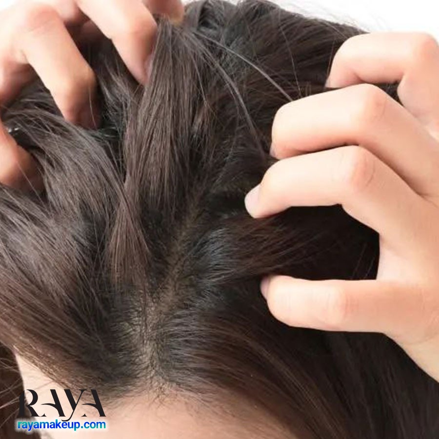 چگونه با روش های طبیعی از شر شوره سر در زمستان خلاص شویم؟