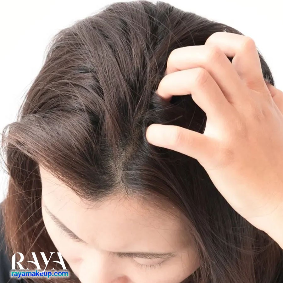 روش های طبیعی و خانگی برای درمان خارش پوست سر	