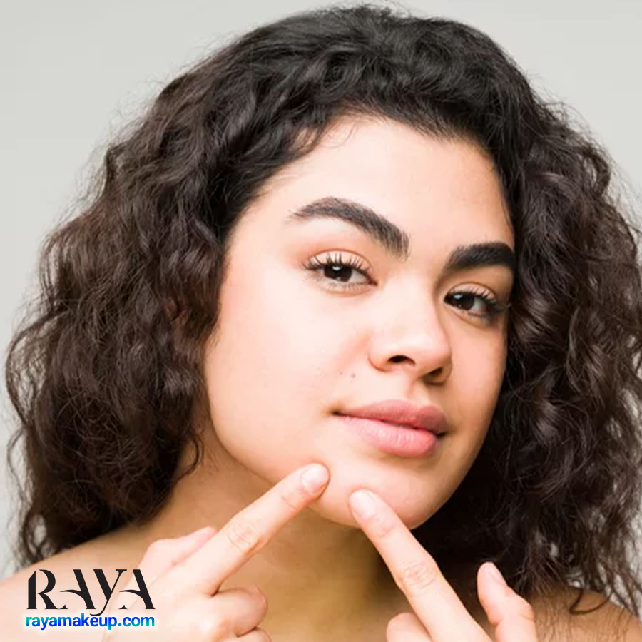 چگونه جوش های سر سیاه روی چانه را از بین ببریم؟ 