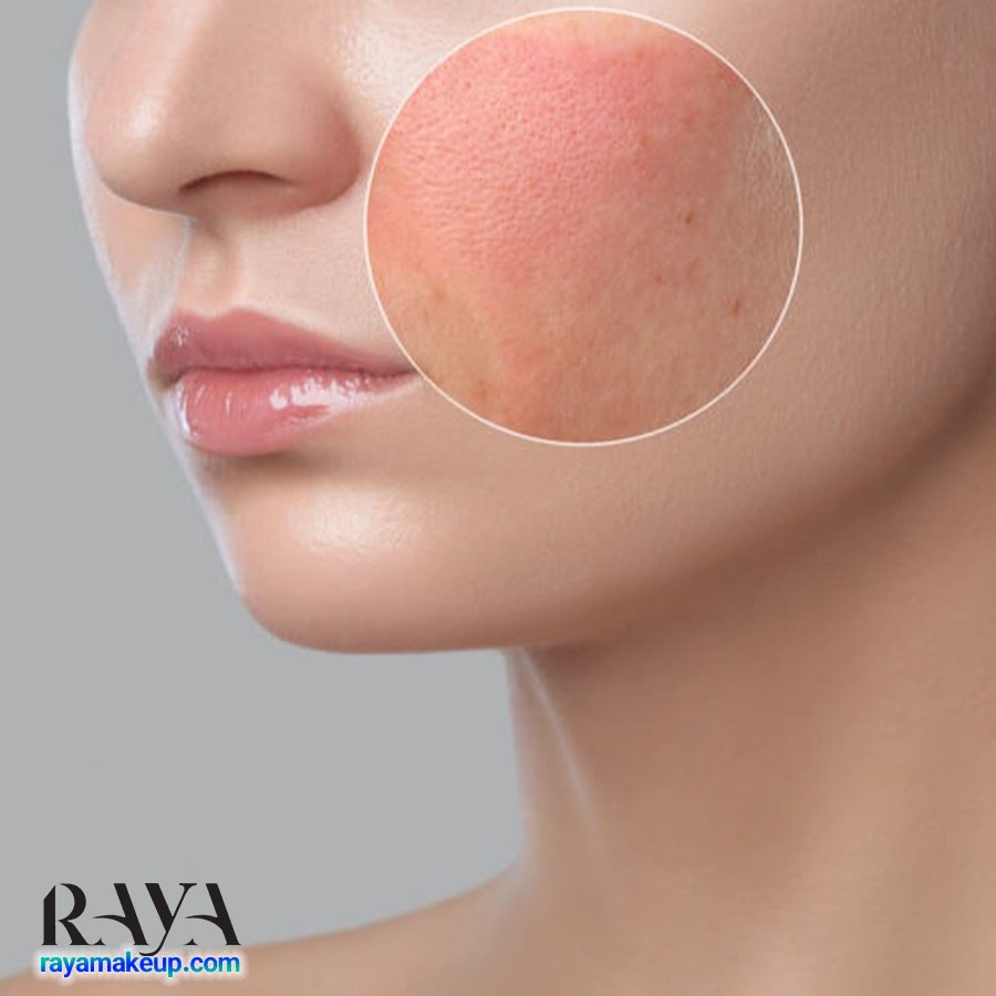 فواید روغن خولان دریایی برای پوست و نحوه استفاده از آن	