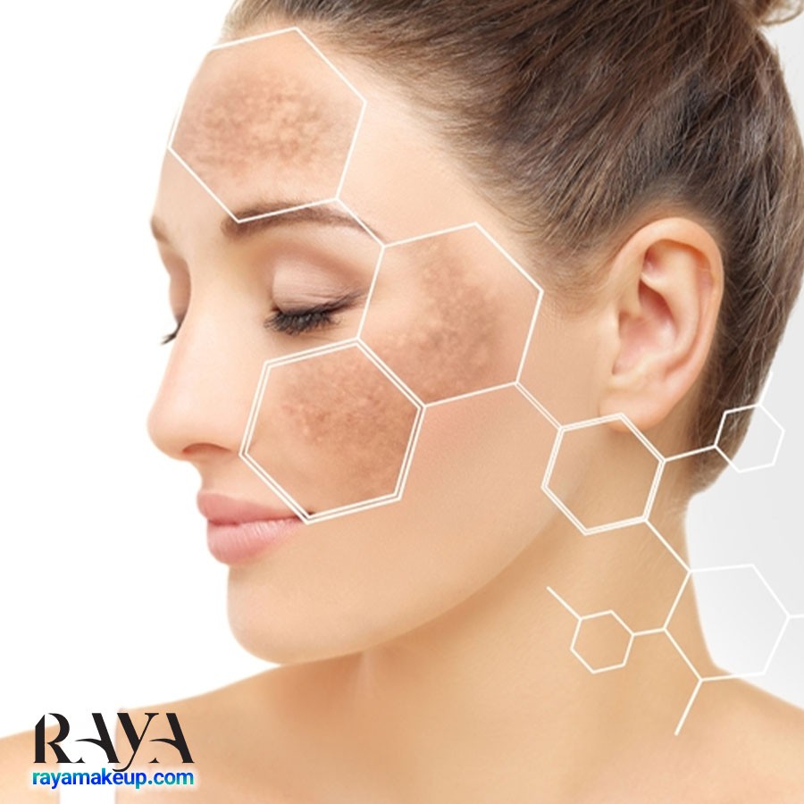 اهمیت استفاده از ضد آفتاب و نحوه استفاده از آن	