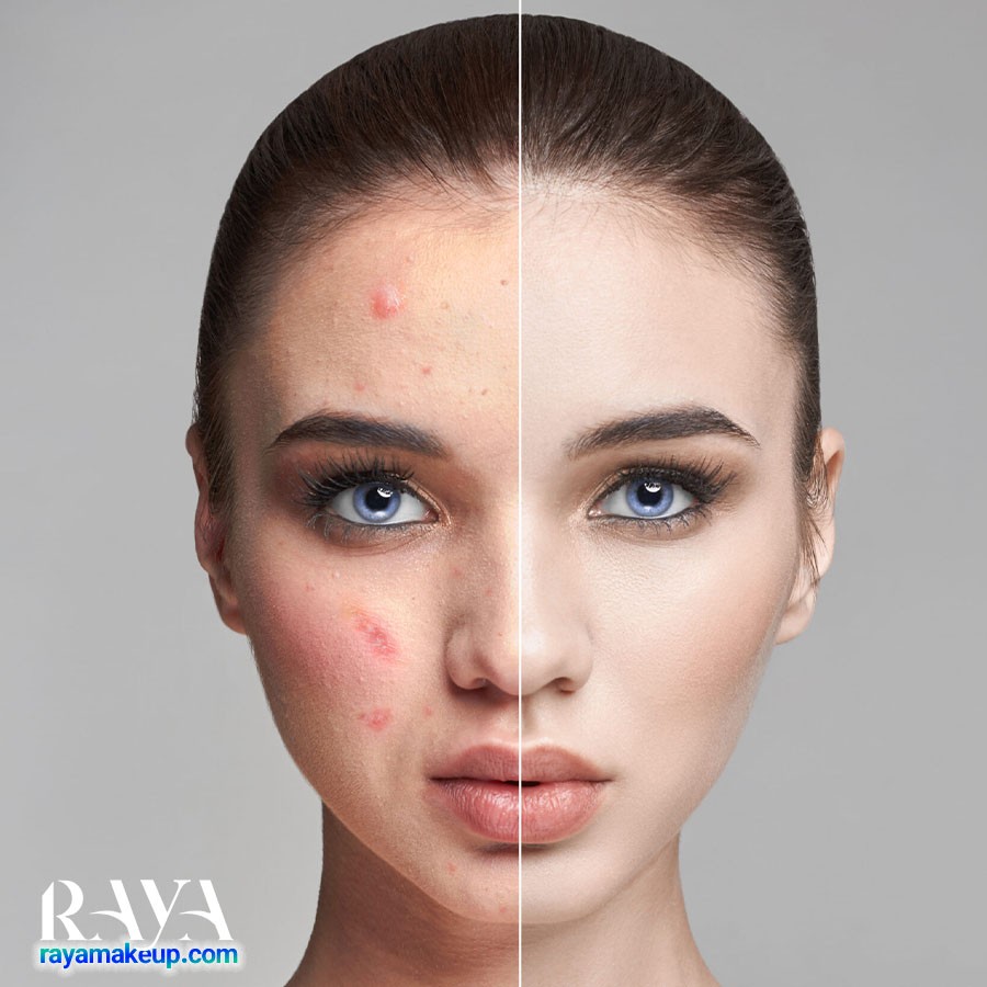 فواید روغن آرگان برای پوست صورت و نحوه استفاده آن 	