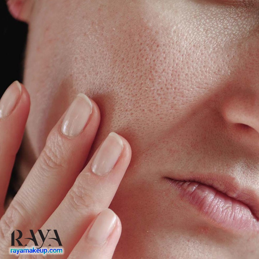 بررسی علل بزرگ شدن منافذ بینی و 12 نکته مهم برای پاکسازی و درمان آنها	