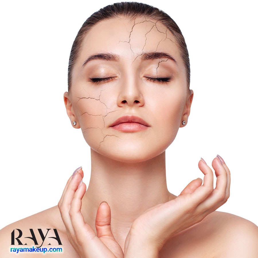 علائم آلرژی و حساسیت پوست خشک به همراه درمان موثر آن