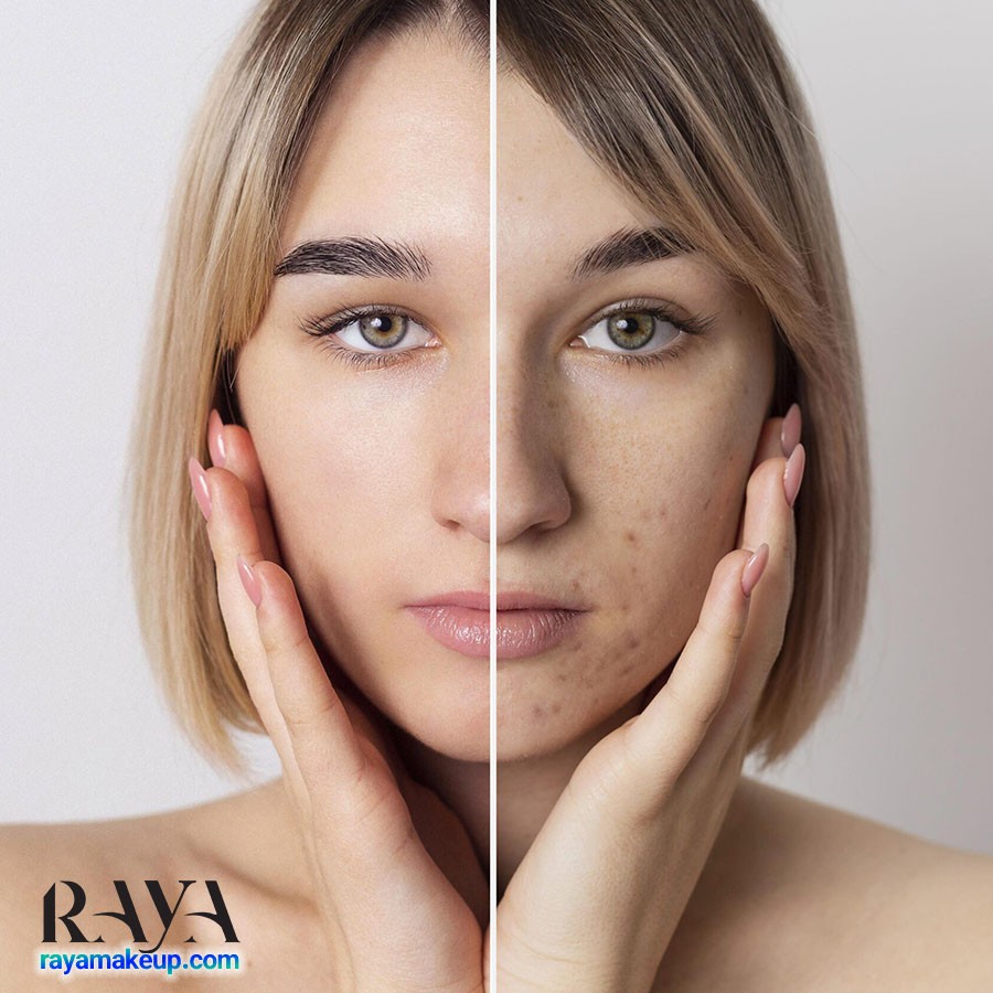 چگونه منافذ پوست را با آرایش بپوشانیم؟ 	