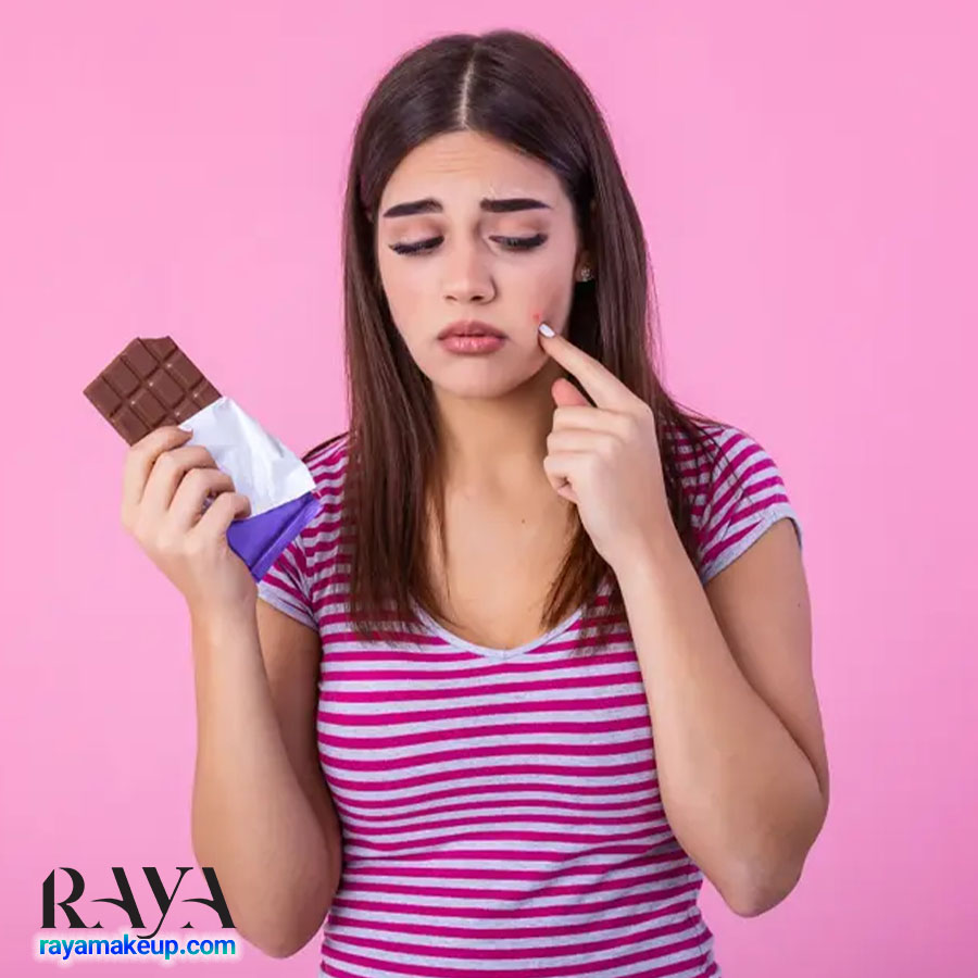 آیا شکلات باعث جوش می شود؟