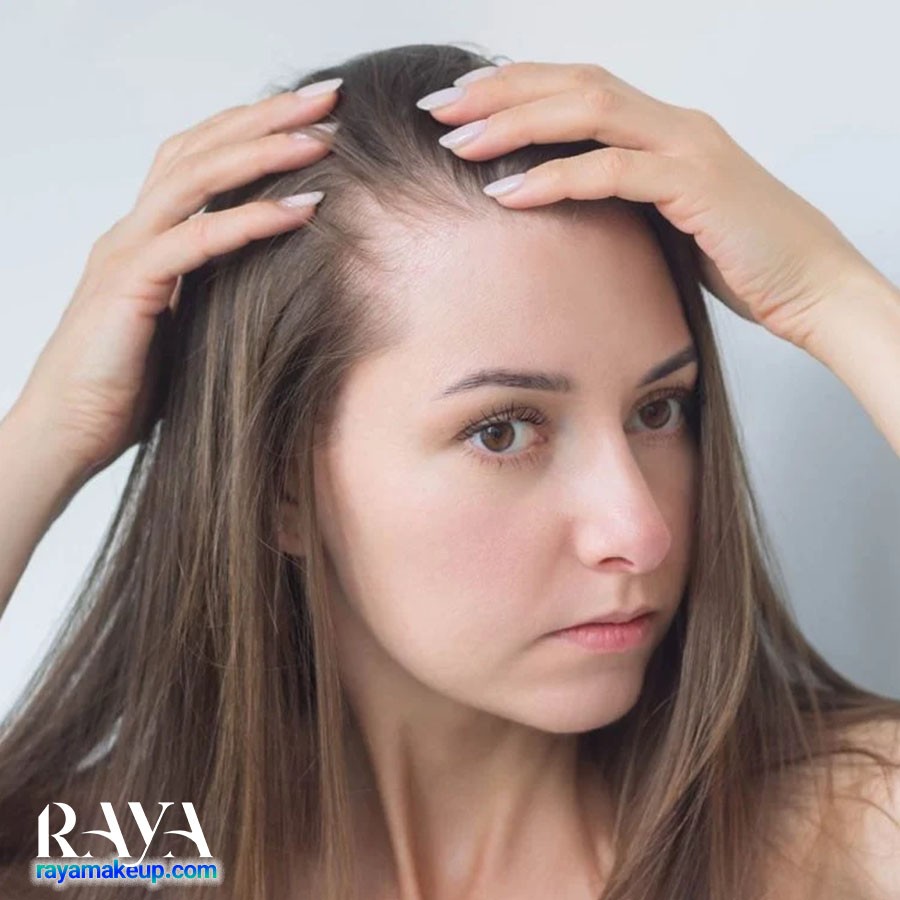 علت ریزش مو در نوجوانان چیست و چگونه درمان می شود؟ 	