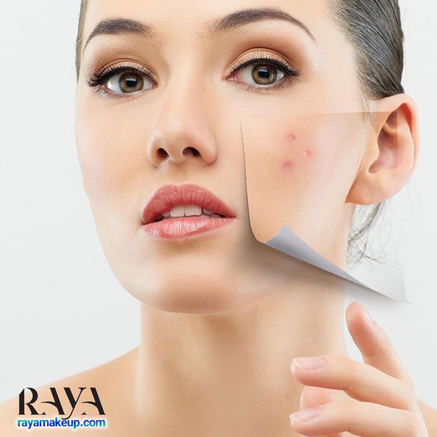 چگونه پوست خود را قبل از عروسی آماده کنیم؟	