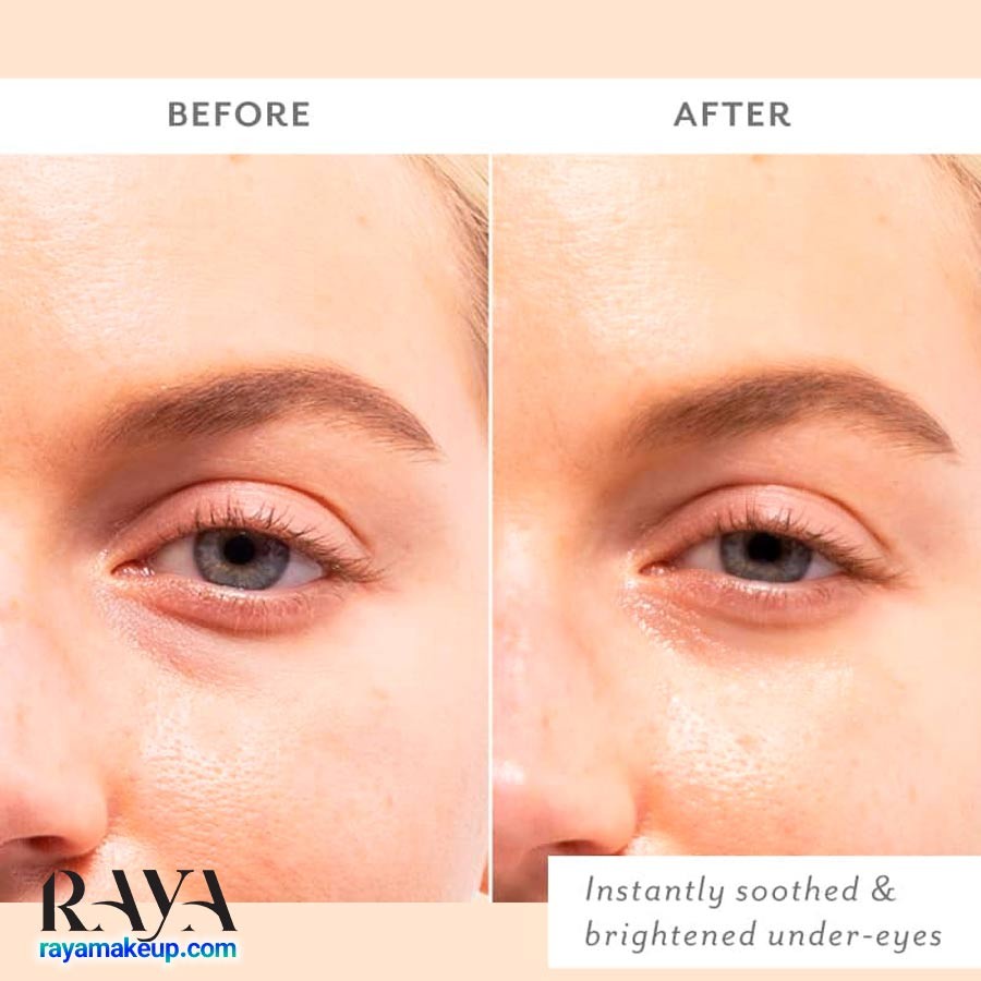 پچ ژل دور چشم تسکین دهنده پچولوژی Patchology Skin Remedy Soothing Eye Gels