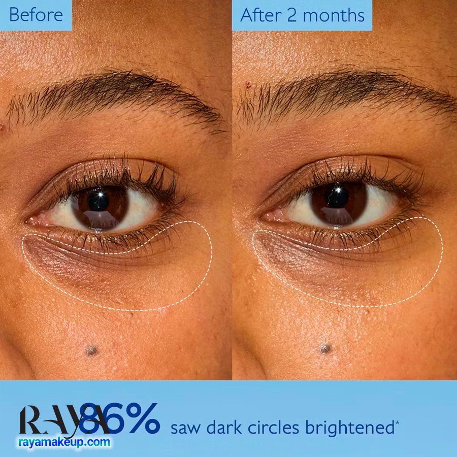 کرم دورچشم وینوپرفکت کدلی روشن کننده و ضد تیرگی Caudalie Vinoperfect Dark Circle Brightening Eye Cream