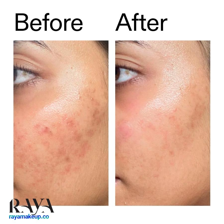 سرم آبرسان و تقویت کننده سد پوستی اینکی لیست The Inkey List Ectoin Hydro-Barrier Serum
