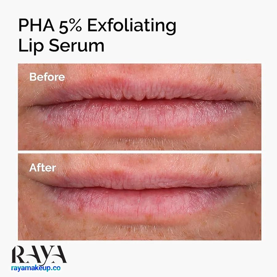سرم لایه بردار لب حاوی 5% PHA اوردینری The Ordinary PHA 5% Exfoliating Lip Serum