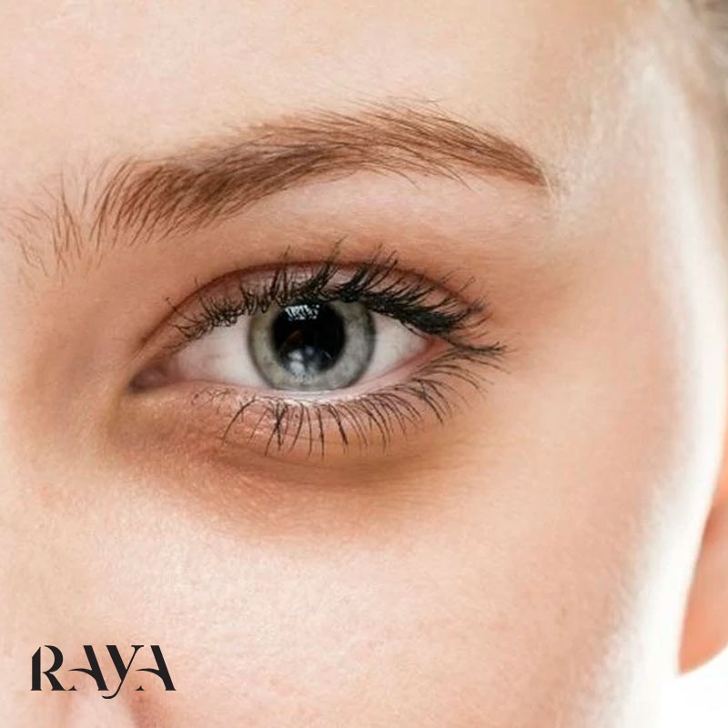 دلایل تیرگی پوست زیر چشم و روش های ساده برای رفع تیرگی دور چشم