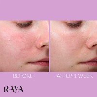 سرم بازسازی کننده پوست مدل دلیکیت ریکاوری کیت سامرویل