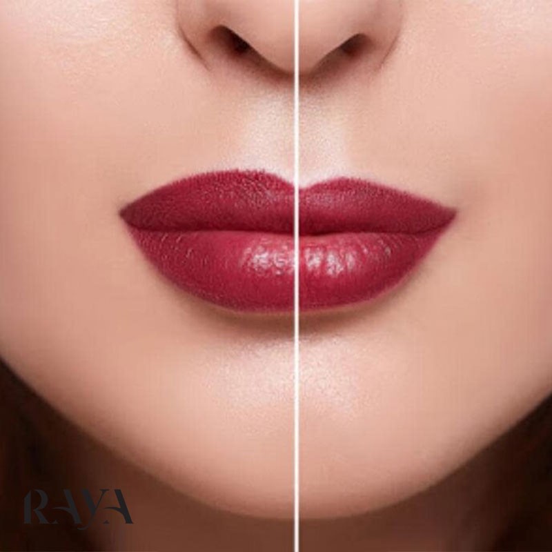 چگونه می توان لب های حجیم و زیباتری داشت؟ معرفی انواع روش حجیم کردن لب ها