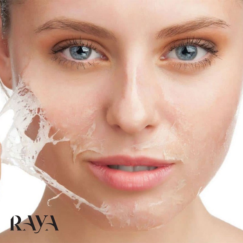 به هنگام خرید لایه بردارها به چه نکاتی باید دقت کنیم؟