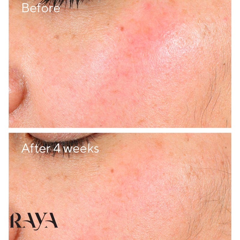 کرم آبرسان ضد استرس و تسکین دهنده قوی پوست اینتنس ریکاوری دکتر مورد Murad Intense Recovery Cream