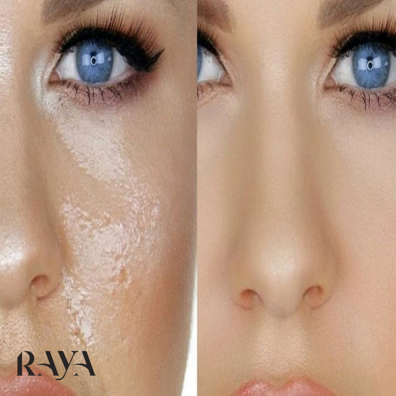 چگونه می توان میزان ترشح چربی اضافی پوست را کاهش داد؟
