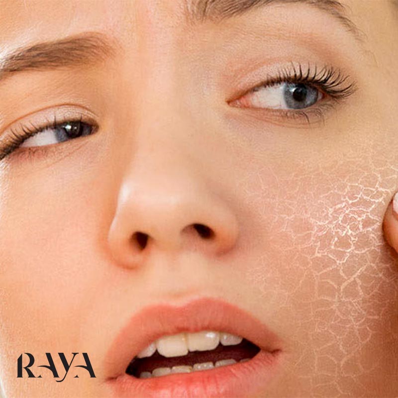 تفاوت های پوست دهیدراته و پوست خشک