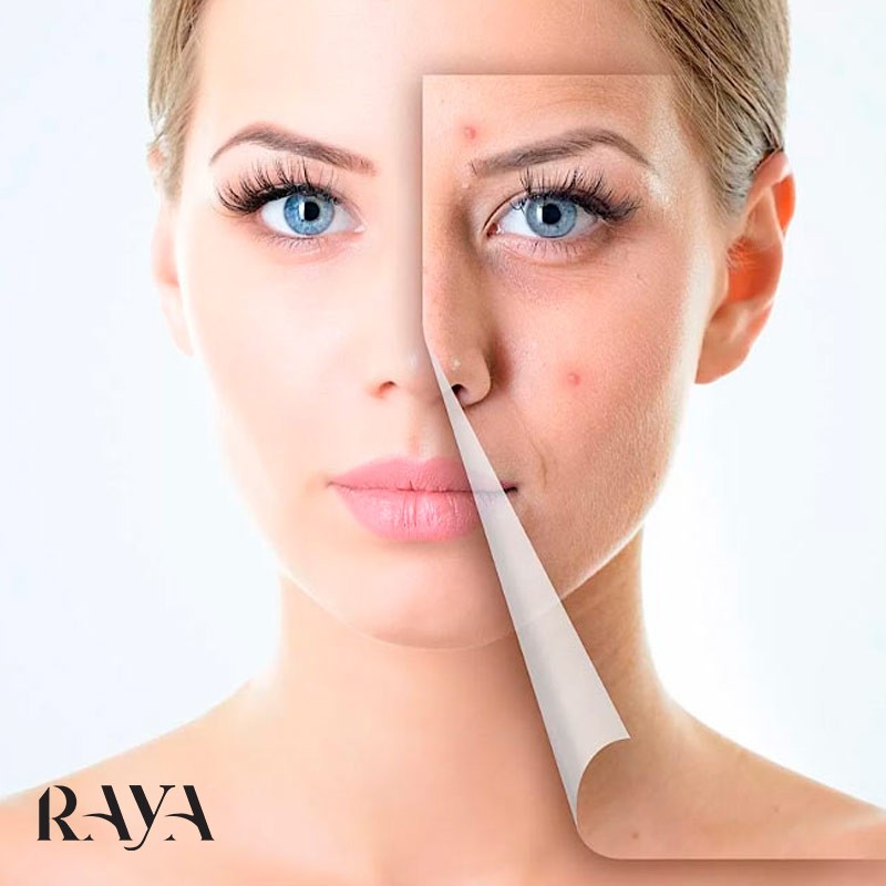 کدام سرم اوردینری برای من مناسب است؟