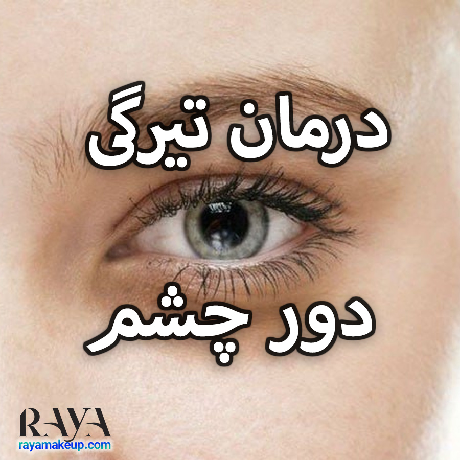 درمان تیرگی دور چشم